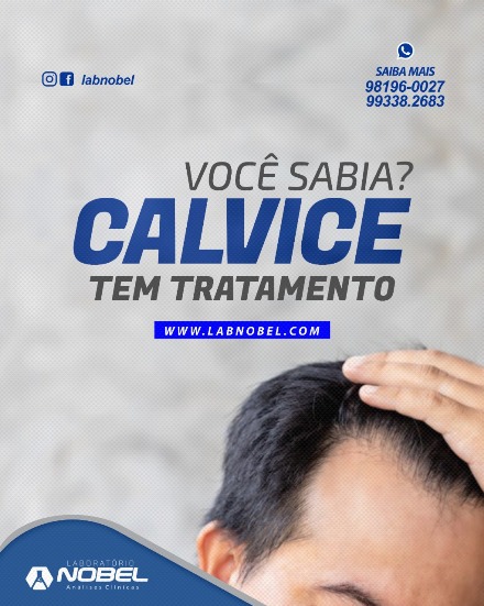 Calvície tem tratamento